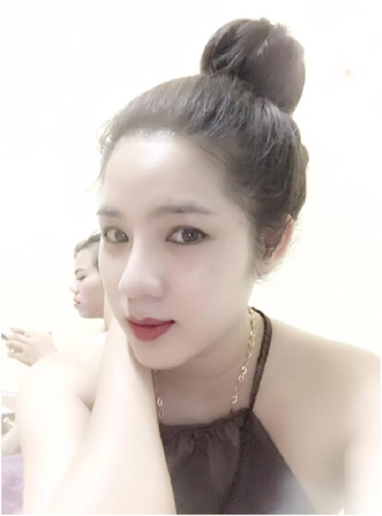 9X Lào Cai thay đổi bất ngờ nhờ chọn đúng dịch vụ thẩm mỹ