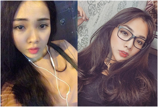 Với thẩm mỹ, con gái chỉ cần cắt mí và nâng mũi là đã rất xinh rồi