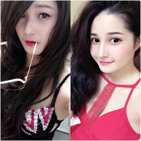 Với thẩm mỹ, con gái chỉ cần cắt mí và nâng mũi là đã rất xinh rồi