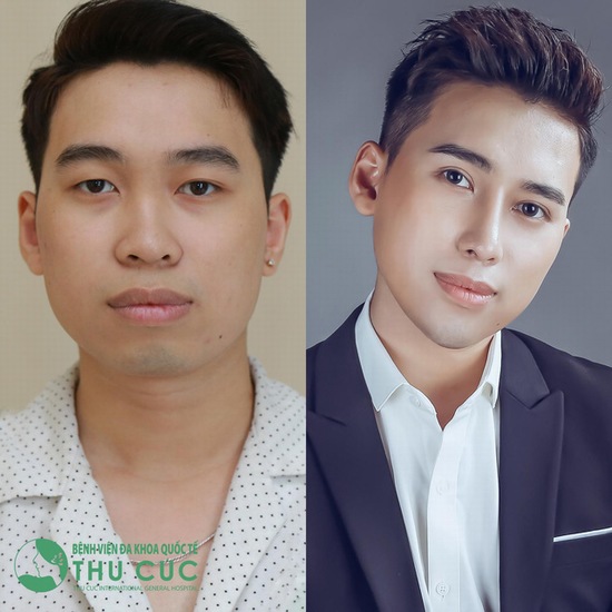 Những ca phẫu thuật thẩm mỹ hot nhận được nhiều chú ý của cộng đồng mạng