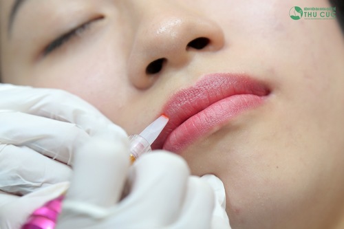 Để thực hiện phun môi pha lê các chuyên gia sẽ sử dụng thiết bị phun xăm siêu vi hạn chế tối đa xâm lấn, tổn thương vùng môi.