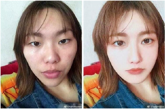 Thời đại thẩm mỹ, các chị em chẳng còn lo bị “lật tẩy” sống ảo
