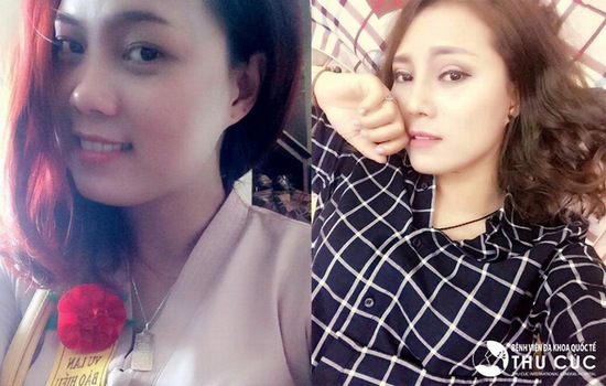 Combo làm đẹp “thần thánh” giúp giới trẻ không sợ lật tẩy sống ảo