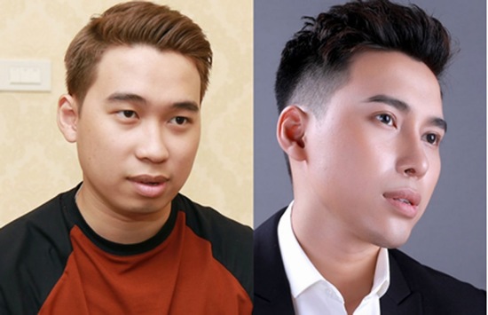 Điểm danh những ca phẫu thuật thẩm mỹ “lột xác” gây bão mạng