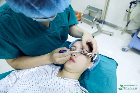 Lý giải cơn sốt phẫu thuật thẩm mỹ cắt mí mắt 2017