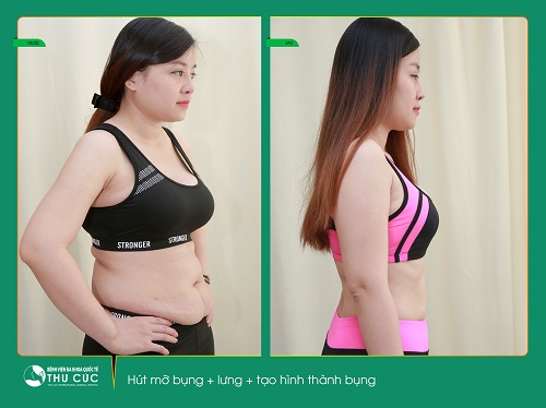 Bạn chỉ cần 2 giờ để tạm biệt bụng“bự”một cách nhanh chóng, an toàn (Lưu ý: Kết quả còn tùy thuộc vào cơ địa mỗi người)
