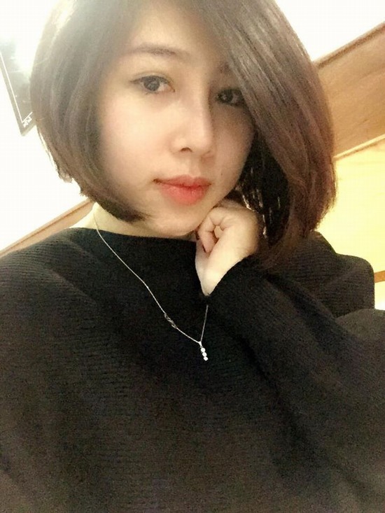 Chỉ chưa đầy 1 tháng sau phẫu thuật, cô nàng Phi Nga đã sở hữu được dáng mũi S line thanh tú, tự nhiên
