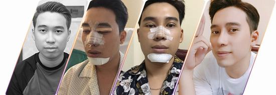 Đinh Quang Đạt và hành trình thay đổi diện mạo.