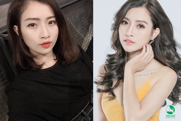 Chuyên viên trang điểm Nguyễn Lệ Thảo Linh cũng nhờ cậy đến cắt mí Pro Mini Deep để gương mặt xinh đẹp, rạng rỡ hơn