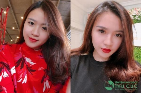 Chỉ 1 chút thay đổi ở đôi mắt đã giúp Dương Bảo Yến xinh đẹp và nổi bật hơn trông thấy