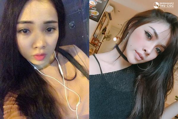 Chiếc mũi cao thẳng ấn tượng của Hải Anh đã "cứu cánh" cho cả gương mặt cô