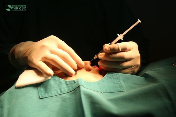 Khách hàng được thực hiện gây tê trước khi phẫu thuật bởi đội ngũ bác sĩ gây tê chuyên nghiệp