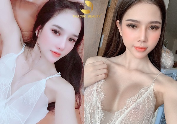 Hàng triệu khách hàng đã "lột xác", bao giờ đến lượt bạn?(Lưu ý: Kết quả tùy thuộc cơ địa mỗi người)