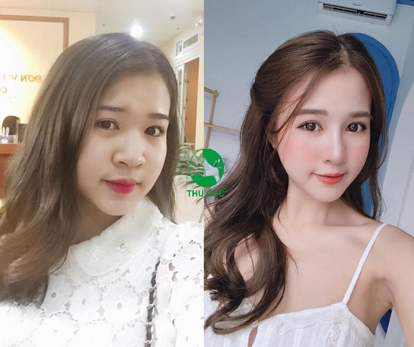 Cũng trong sự kiện này, lần đầu tiên có sự xuất hiện của các combo làm đẹp cực hot với chi phí giảm giá cực sốc