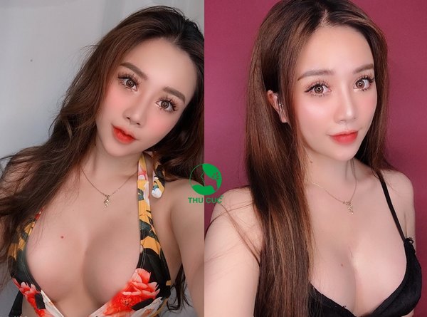 Tất cả các dịch vụ thẩm mỹ tại Thu Cúc đều được giảm giá mạnh