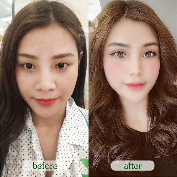 Thu Cúc cam kết về chất lượng và đảm bảo an toàn tuyệt đối cho tất cả các dịch vụ