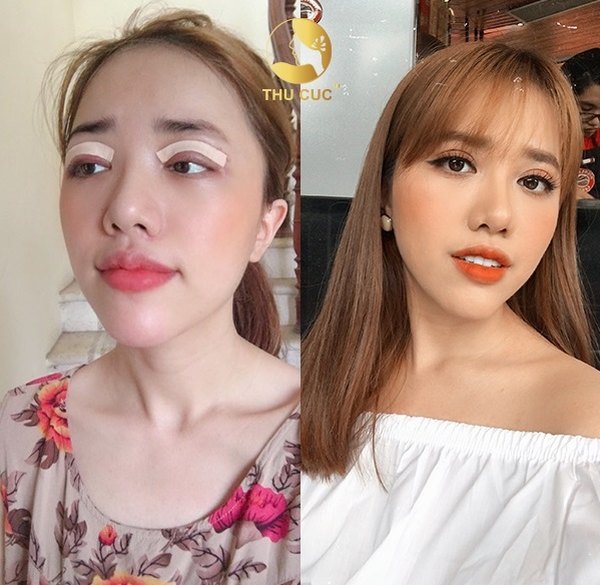Trong chương trình lần này khách hàng sẽ được tặng 100% giá trị của 4 dịch vụ thẩm mỹ hot nhất hiện nay