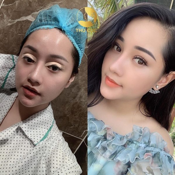 Nhanh tay đăng ký để không bỏ lỡ các dịch vụ làm đẹp xịn sò tại Thu Cúc