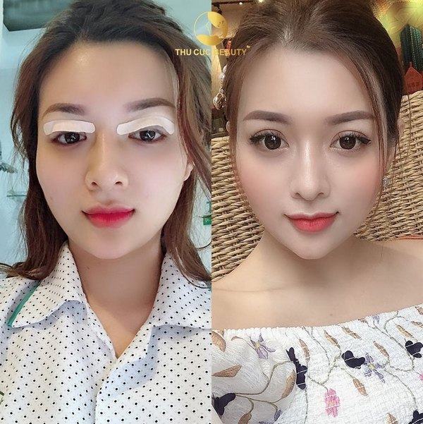 Đôi mắt 2 mí đẹp hoàn hảo, tự nhiên hết ý với công nghệ cắt mí chuẩn Mỹ hiện đại tại Thu Cúc Sài Gòn