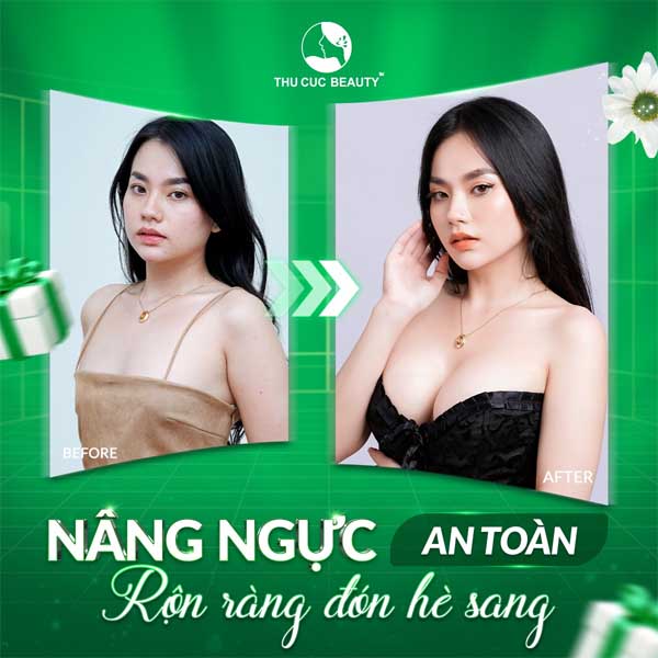 Nâng ngực có  không?