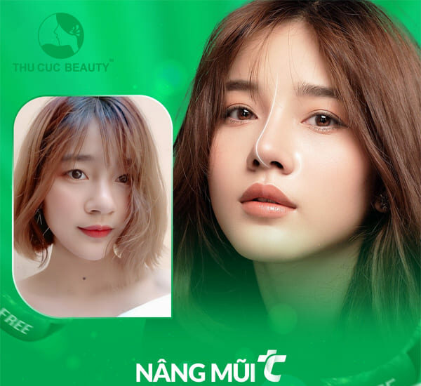 Nâng mũi có hại về sau không?