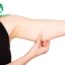 Hút mỡ cánh tay – Kỹ thuật cảm ứng phân tách mỡ đỉnh cao