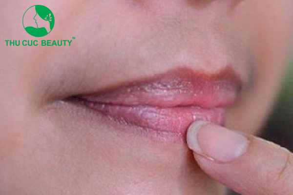 viền môi bị thâm sau khi xăm