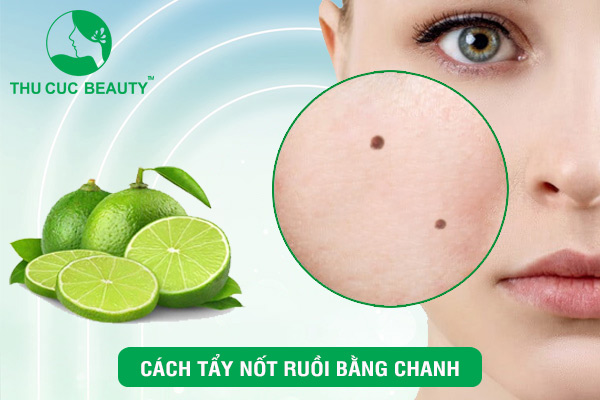 Cách tẩy nốt ruồi bằng chanh