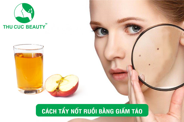 Tẩy nốt ruồi bằng giấm táo