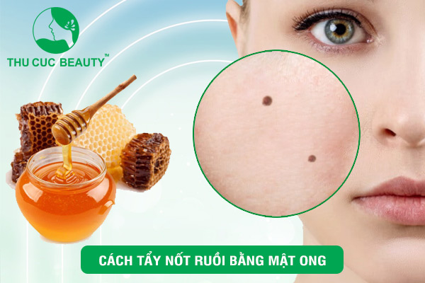 Cách tẩy nốt ruồi bằng mật ong