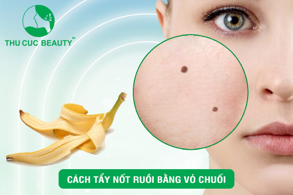 Cách tẩy nốt ruồi bằng vỏ chuối