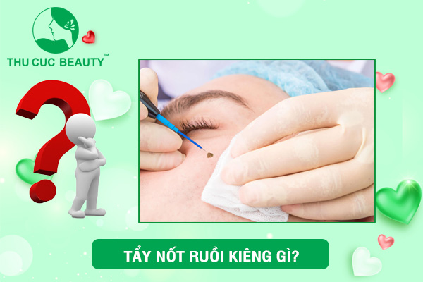 Tẩy nốt ruồi kiêng gì?