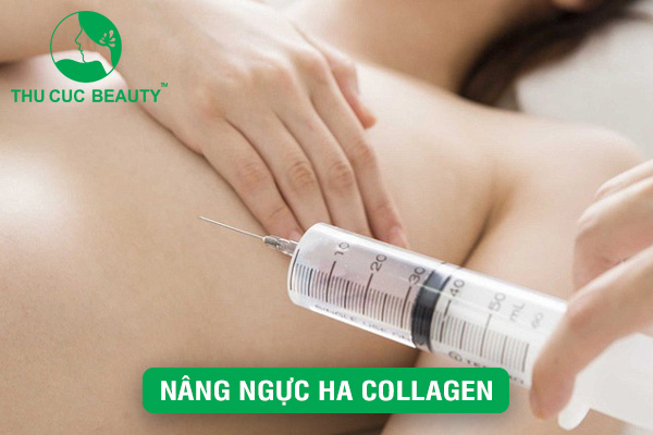 Nâng ngực HA Collagen