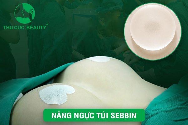 Nâng ngực túi Sebbin – Vòng 1 đẹp tự nhiên, quyến rũ