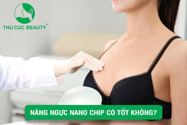 nâng ngực Nano Chip có tốt không