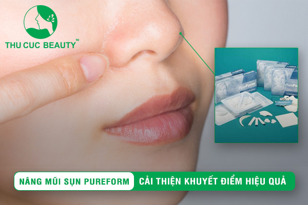 Nâng mũi sụn Pureform – Cải thiện khuyết điểm hiệu quả