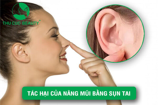 tác hại của nâng mũi sụn tai