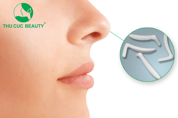 yếu tố tác động tới thời gian duy trì dáng mũi
