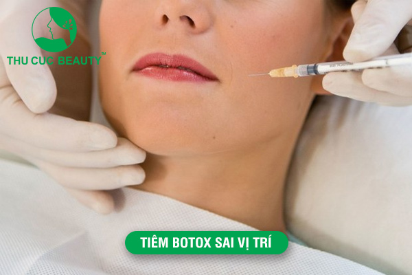 Tiêm Botox sai vị trí có nguy hiểm không?