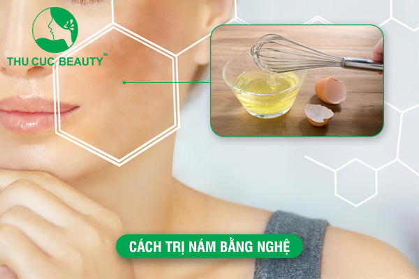 Cách trị nám bằng nghệ  và hiệu quả