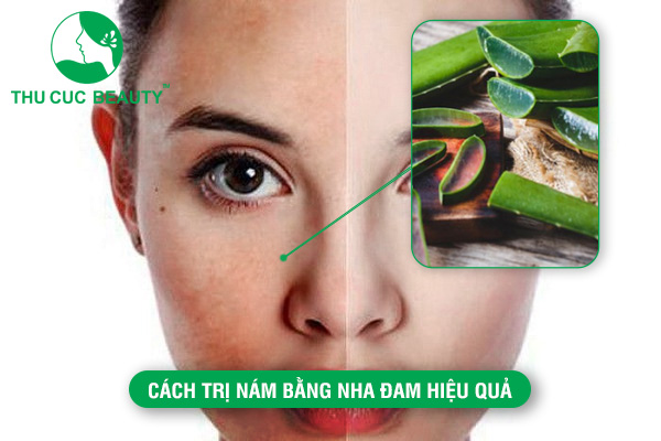 Cách trị nám bằng nha đam hiệu quả