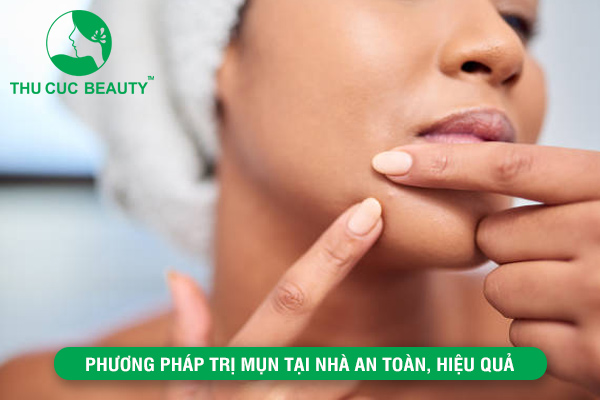 Những phương pháp trị mụn tại nhà , hiệu quả
