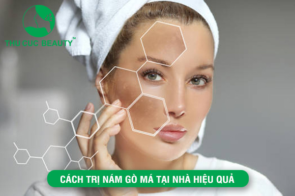 Cách trị nám gò má tại nhà hiệu quả