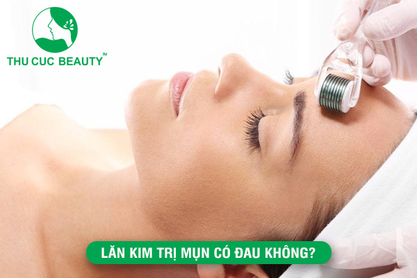 Lăn kim trị mụn có đau không?