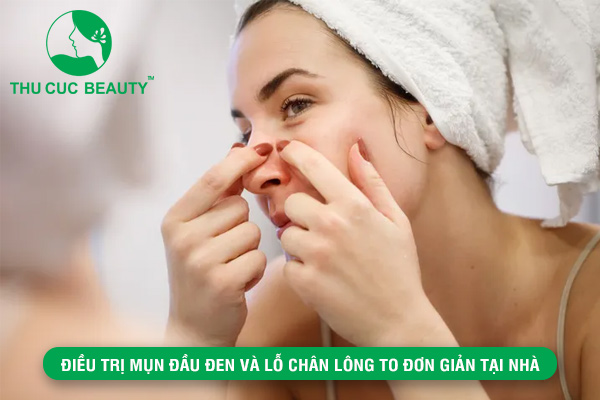 Điều trị mụn đầu đen và lỗ chân lông to đơn giản tại nhà