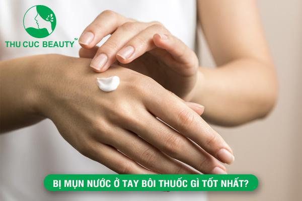 Bị mụn nước ở tay bôi thuốc gì ?