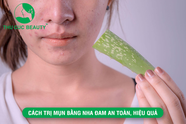 Những cách trị mụn bằng nha đam an toàn, hiệu quả